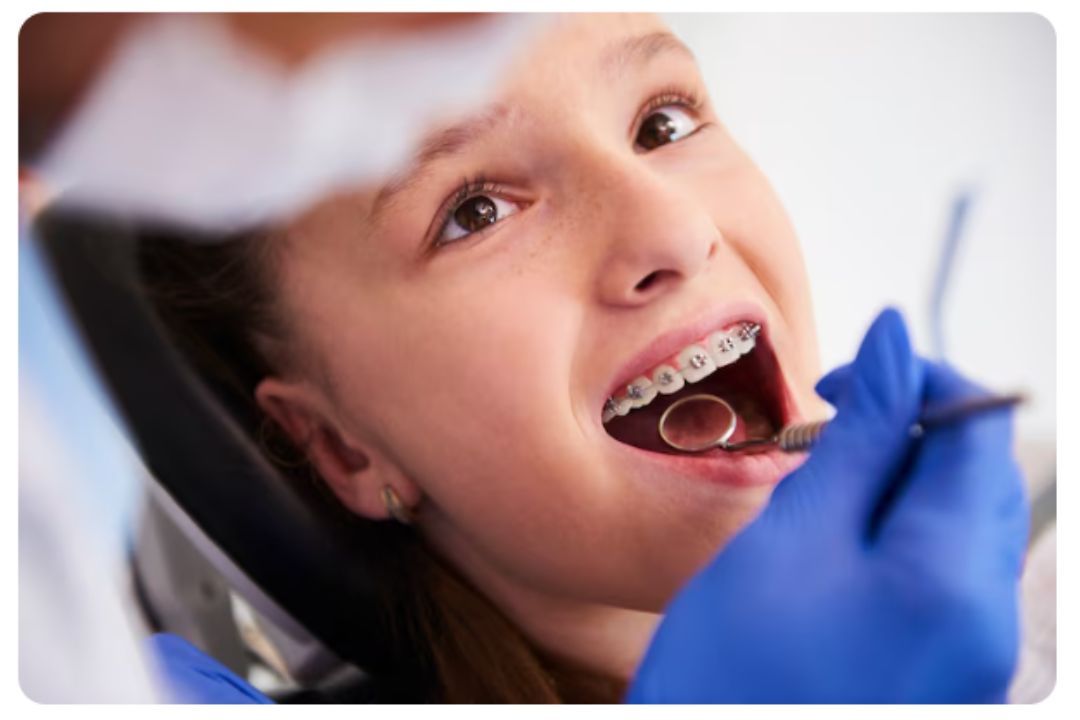 braces for gaps and straight teeth comparison